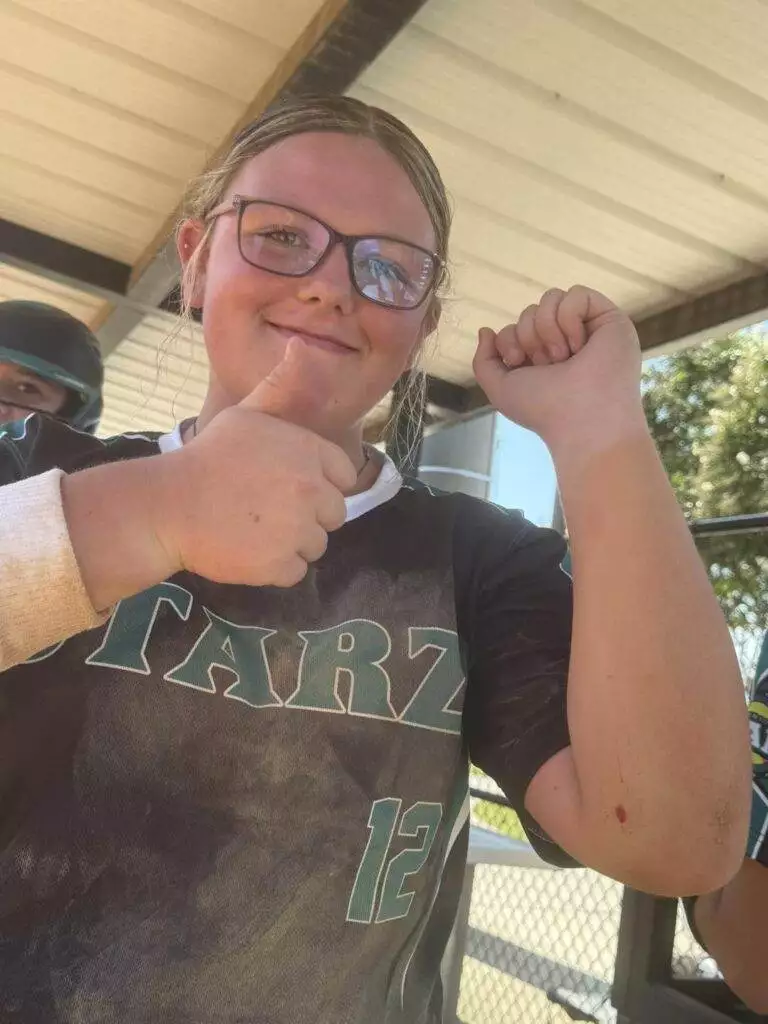 Abby's battle scars at Tier One Edge Showcase tournament - August 9-10, 2025 in Raleigh, NC